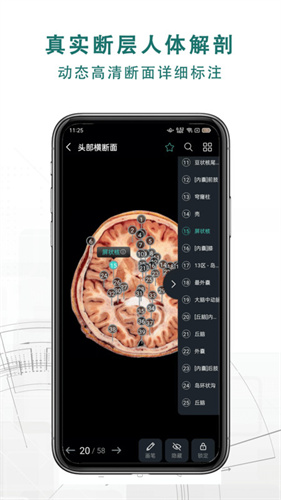 掌上3D解剖截图3